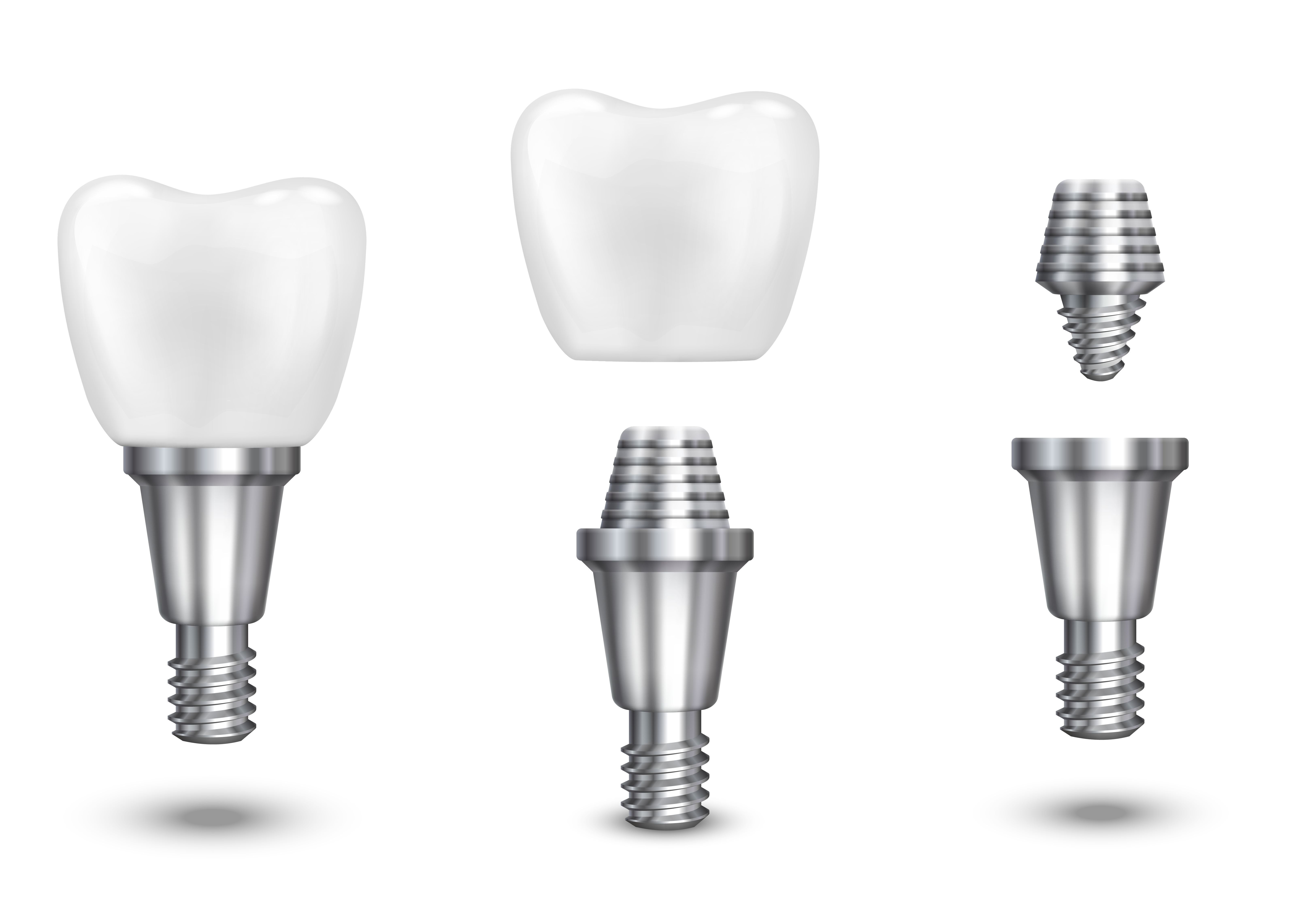 Премиальные зубные импланты Straumann и Nobel – ваше лучшее решение для красивой улыбки